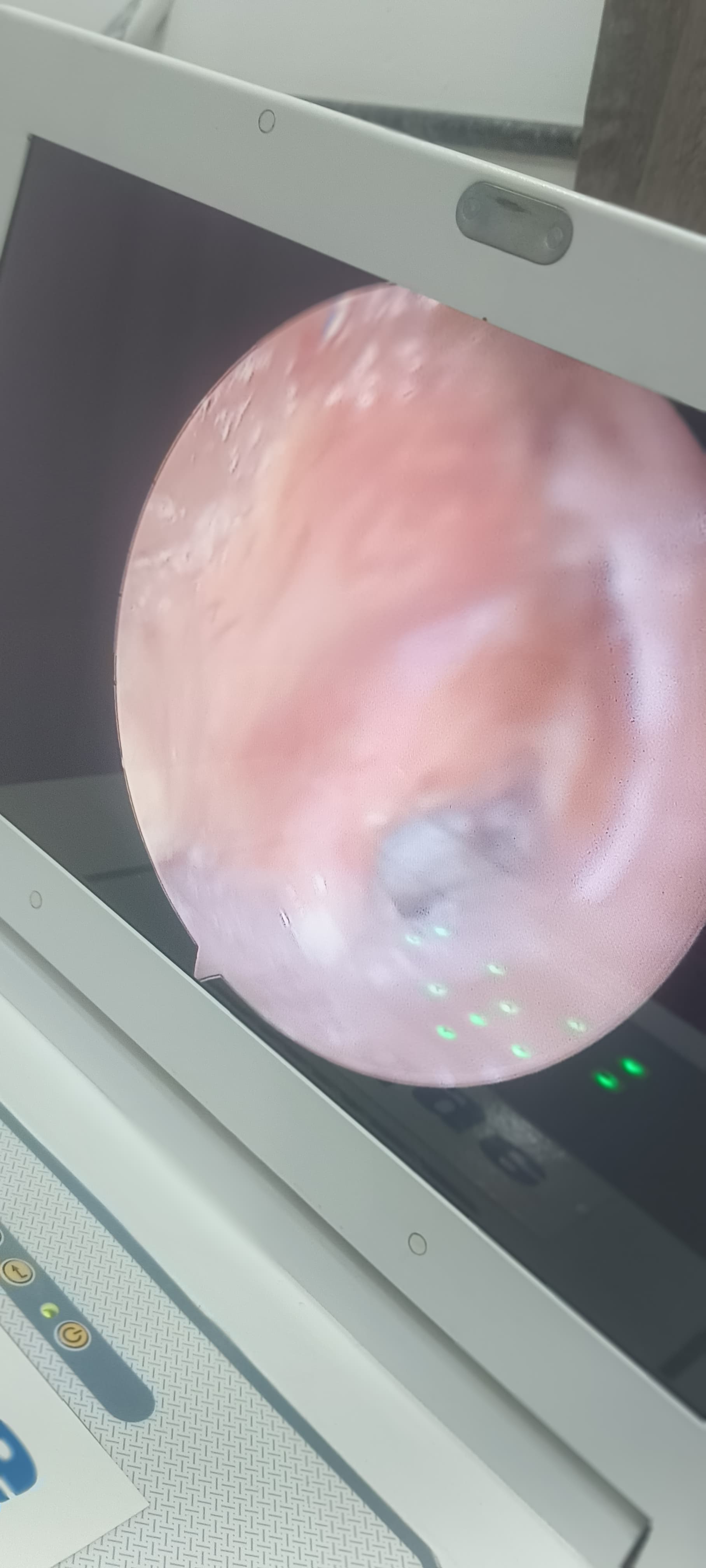 Patient hearing test report at HEARING DIAGNOSTIC HUB